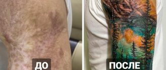 20 tatouages sur des cicatrices et des brûlures qui ont aidé des personnes à transformer leurs défauts en points forts.