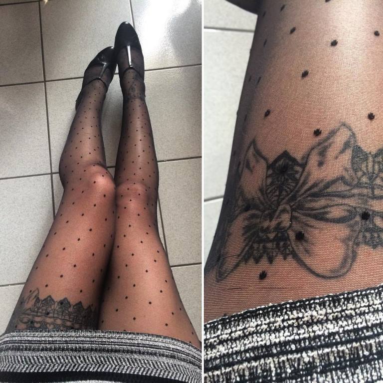 arcs sur les jambes