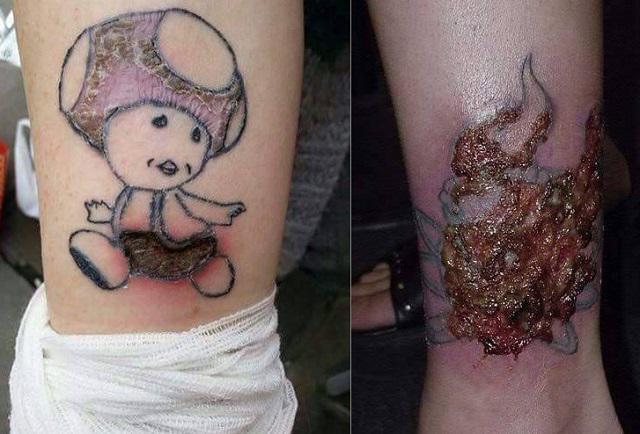 Quels sont les dangers des tatouages ?