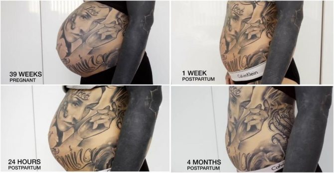 Qu'arrive-t-il à votre tatouage si vous prenez ou perdez du poids ?