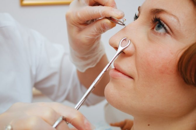 Un médecin insère une boucle d'oreille dans le nez