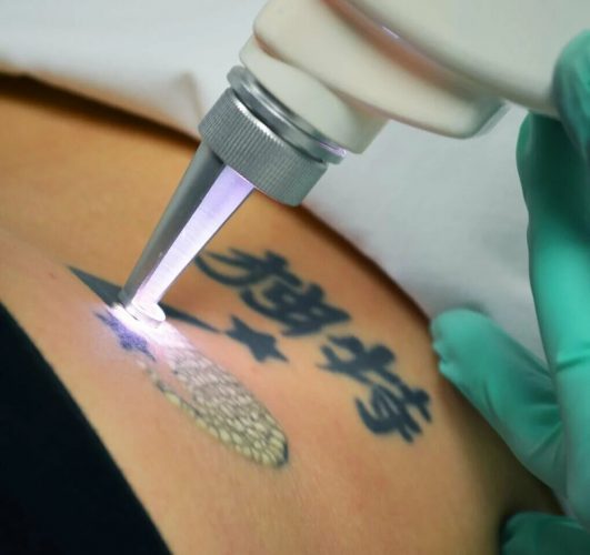 Où il n'y a pas de mal à se faire tatouer sur le corps d'une fille.