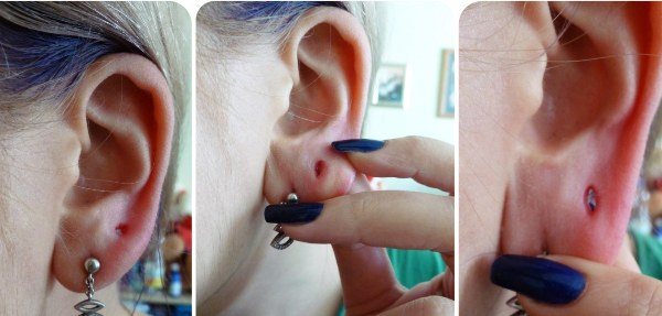 Comment faire et resserrer les tunnels dans les oreilles