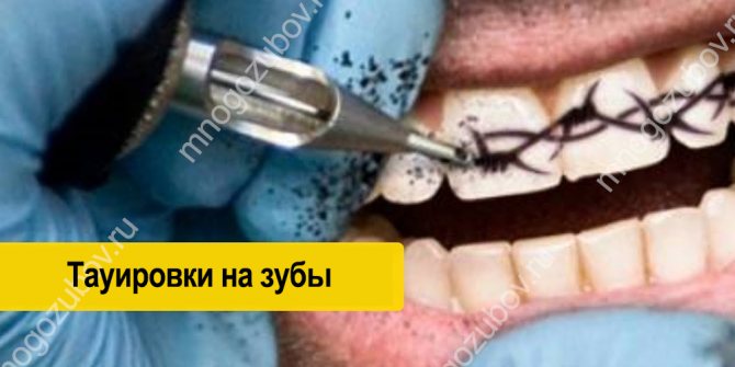 Comment faire des tatouages sur mes dents ?