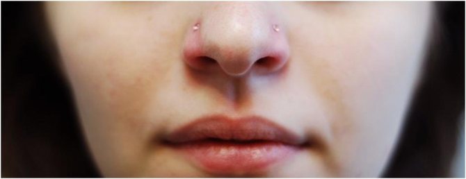 Comment cacher un piercing au nez en toute sécurité
