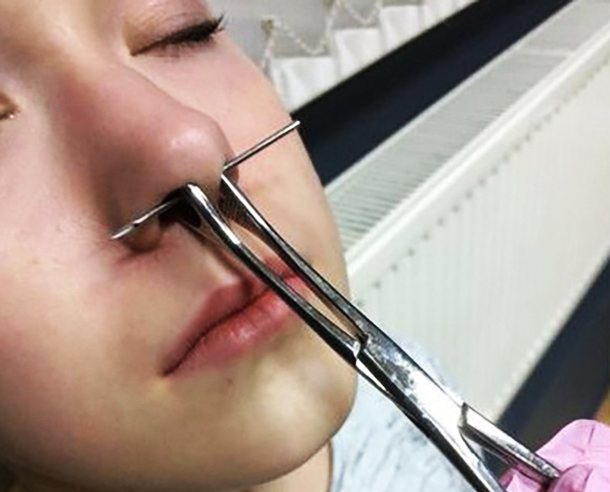 Comment percer un septum piercing à la maison
