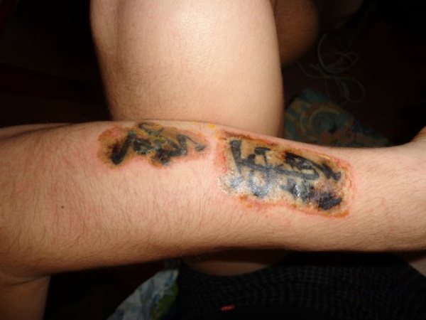 Comment enlever les tatouages, enlever les tatouages à la maison