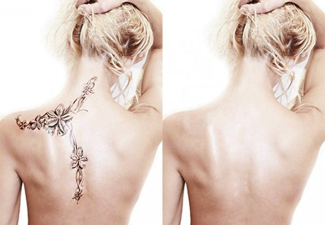 Comment enlever les tatouages
