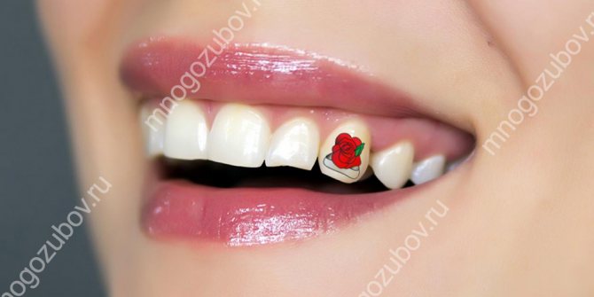À quoi ressemble un tatouage sur les dents ?