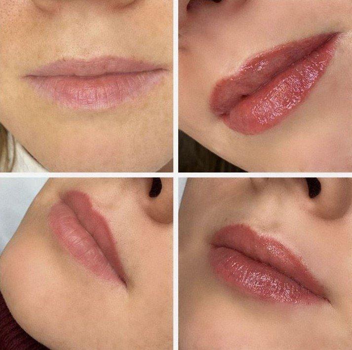 Comment la lèvre guérit-elle après un tatouage - Maquillage permanent