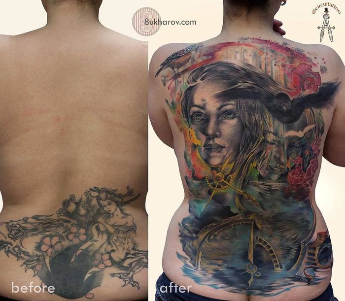 détatouage du dos complet