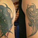 Correction des tatouages