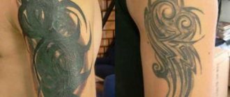 Correction des tatouages