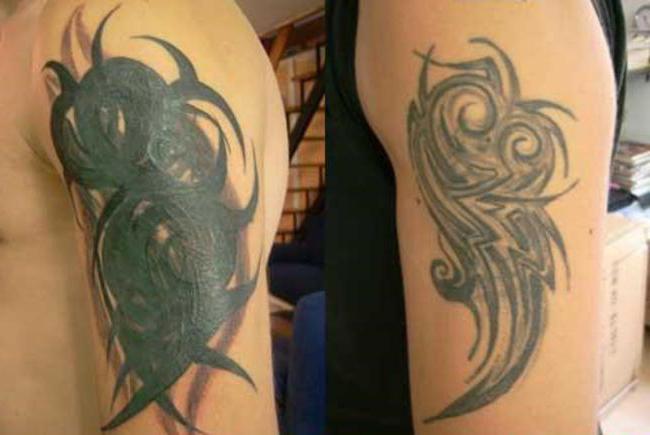 Correction des tatouages