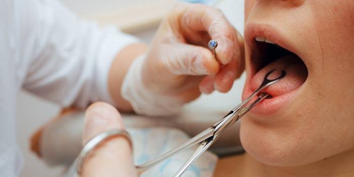 Le médecin se prépare au piercing de la langue