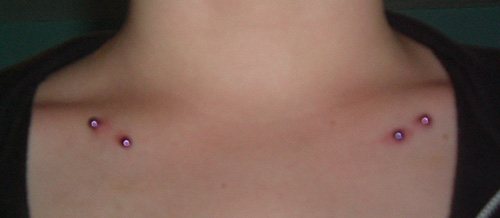 microdermique de la clavicule