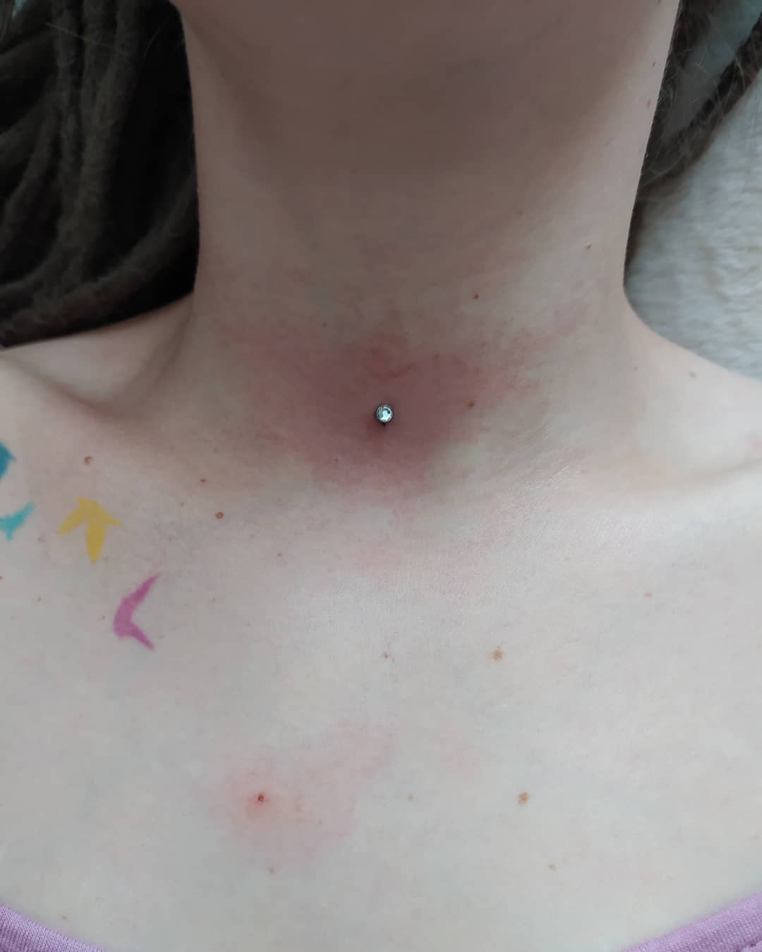 microdermique sur la clavicule