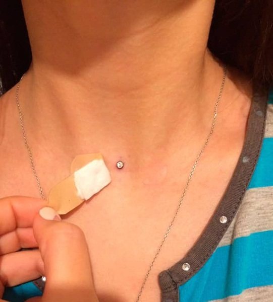 Microdermique sur le cou, le visage, le bras, la poitrine, la clavicule, le bas du dos. Qu'est-ce que c'est, des photos du piercing. Comment faire et réparer