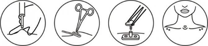 Microdermique sur le cou, le visage, le bras, la poitrine, la clavicule, le bas du dos. C'est quoi, une photo du piercing. Comment faire et attacher