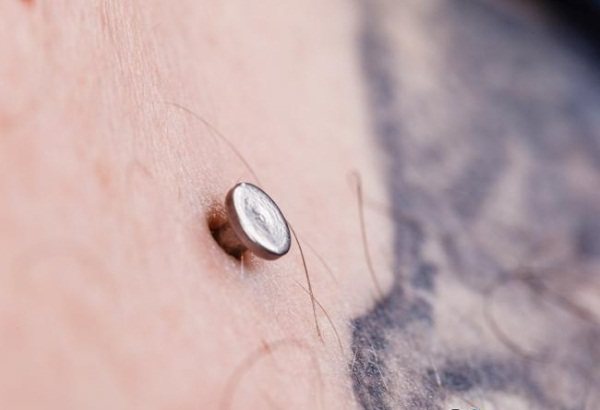 Microdermique sur le cou, le visage, le bras, la poitrine, la clavicule, le bas du dos. Qu'est-ce que c'est, un photo piercing. Comment faire et coller