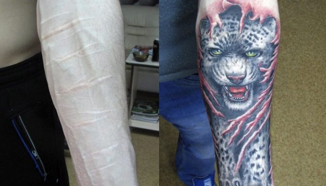 Puis-je me faire tatouer une cicatrice ? Quels sont les tatouages que je peux couvrir ? Réponses aux questions