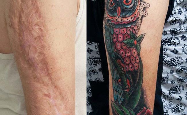 Puis-je me faire tatouer sur mes cicatrices ? Quels sont les tatouages qui peuvent être superposés ? Répondre aux questions