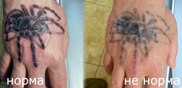 Mauvais entretien des tatouages