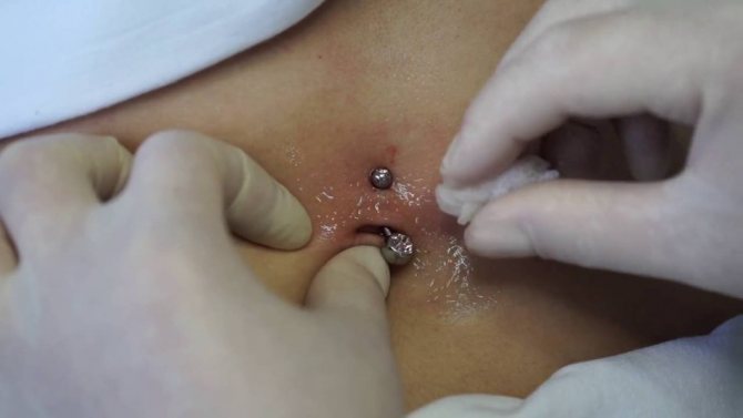 Traitement des piercings
