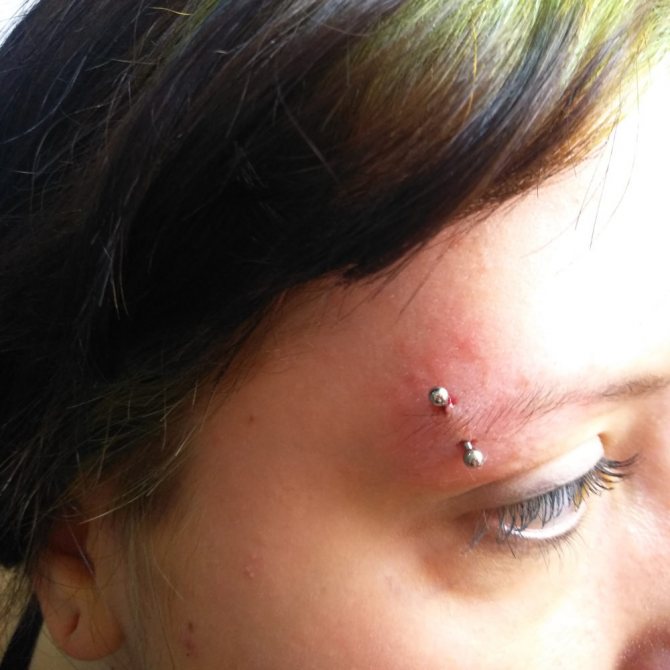 Perçage de sourcils bouffis