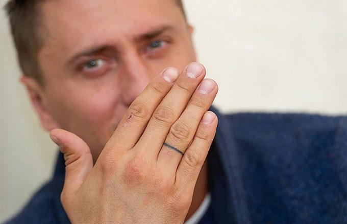 Pavel Raduchny a retiré son tatouage du cou