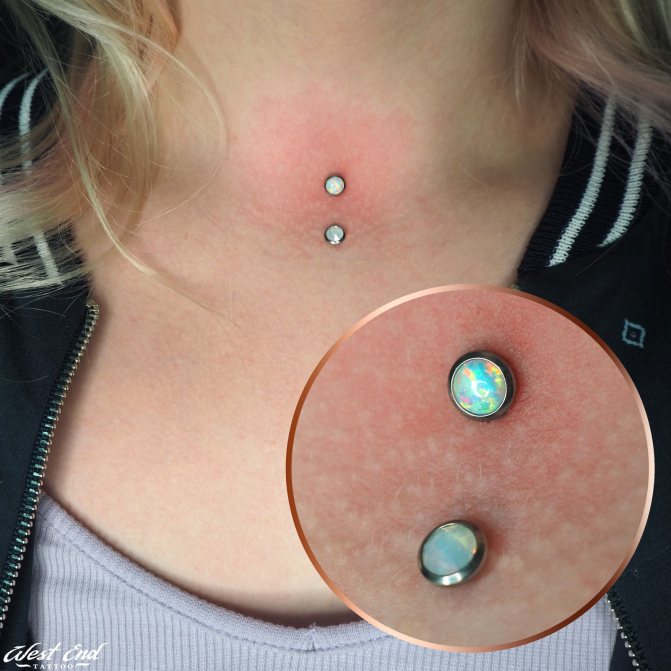 La première étape de la cicatrisation du piercing