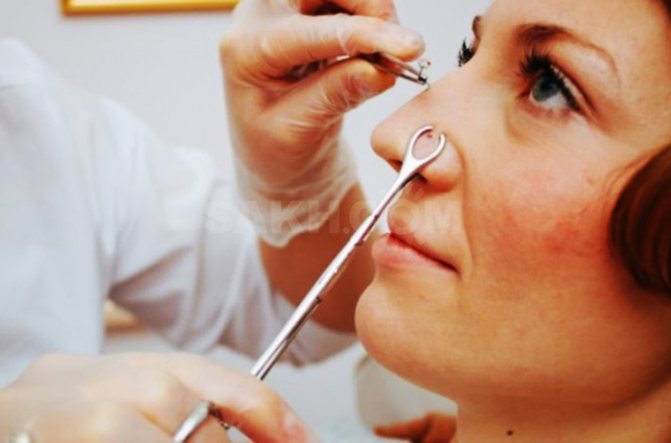 Perçage de l'aile de l'ongle. Nom, soins à domicile, commentaires