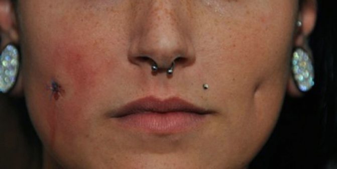 Les piercings aux joues ont fait des fossettes. Image, types, noms