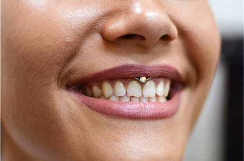 Piercing sous la lèvre supérieure (smiley) sur le frenulum. Photos, conséquences, critiques
