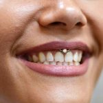 Piercing sous la lèvre supérieure (smiley) sur le frenulum. Photos, conséquences, critiques