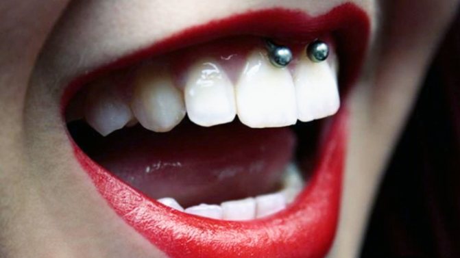 Piercing sous la lèvre supérieure (smiley) sur le frenulum. Photos, conséquences, critiques