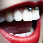 Piercing sous la lèvre supérieure (smiley) sur le frenulum. Photos, conséquences, critiques