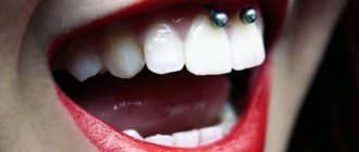 Piercing sous la lèvre supérieure (smiley) sur le frenulum. Photos, conséquences, critiques