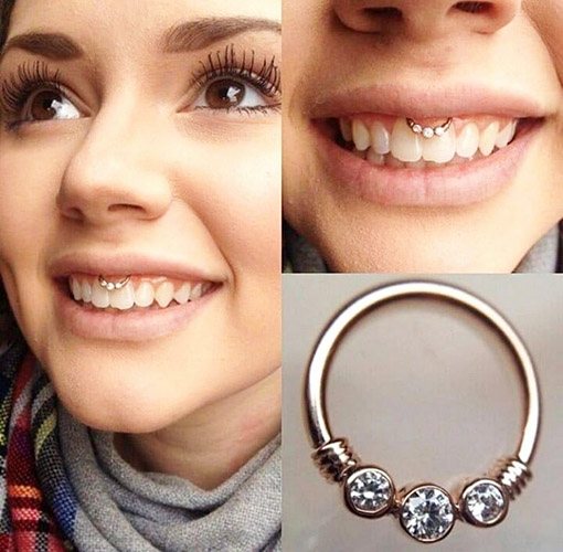 Piercing sous la lèvre supérieure (smiley) sur le frenulum. Photos, conséquences, critiques