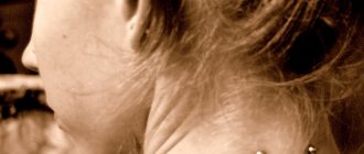 piercing planaire du cou
