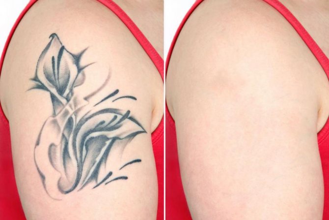 Tatouage exquis