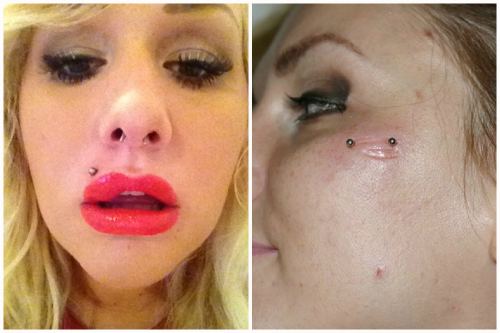 Les conséquences du body piercing