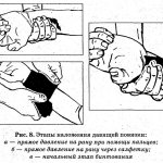 Règles d'application d'un pansement compressif