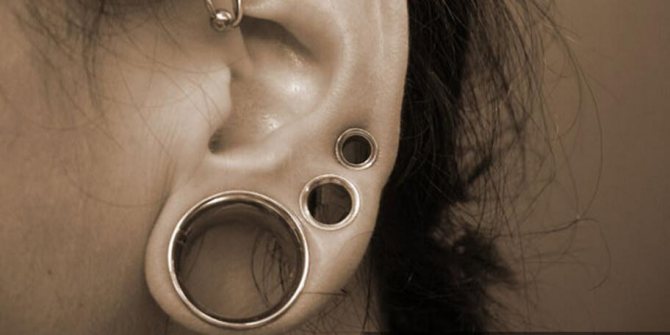 Exemple de plusieurs tunnels sur un lobe d'oreille