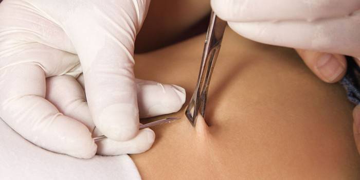 Piercing du nombril