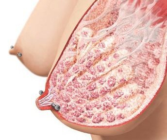 Piercing des mamelons chez les filles. Photos, critiques