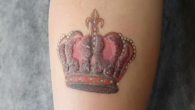 Cicatrices de tatouage