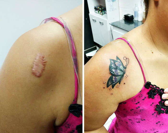 Faites-vous tatouer la cicatrice