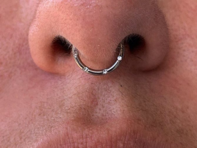 photo du septum