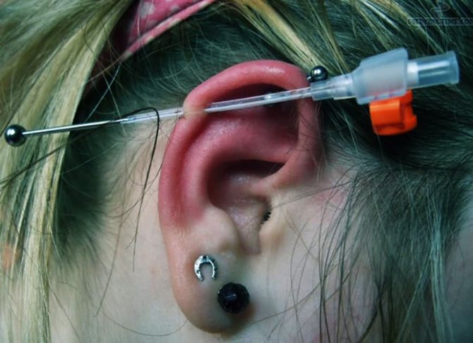 La tige dans l'oreille. Photo industrielle, comme appelé, combien de temps pousse plus, où acheter, prix